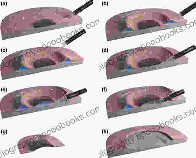 Endoscopic Submucosal Dissection Emerging Frontiers Endoscopic Submucosal Dissection An Issue Of Gastrointestinal Endoscopy Clinics (The Clinics: Internal Medicine 24)