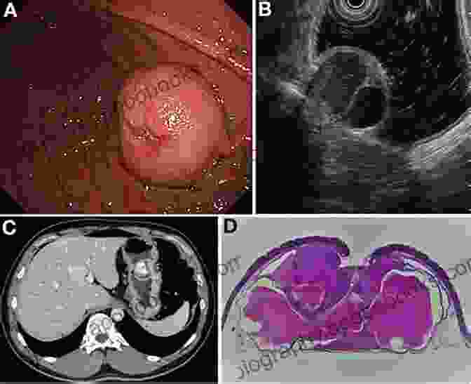 Endoscopic Submucosal Dissection Gastric Lesions Endoscopic Submucosal Dissection An Issue Of Gastrointestinal Endoscopy Clinics (The Clinics: Internal Medicine 24)