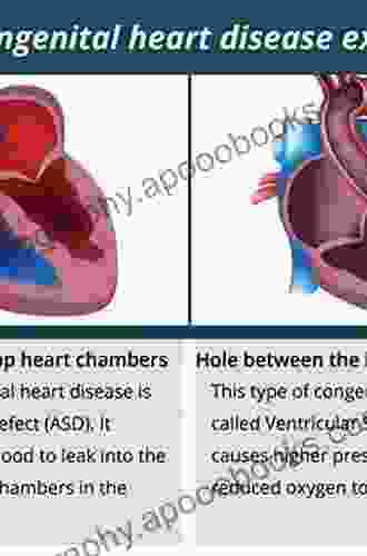 Heart Failure in Adult Congenital Heart Disease (Congenital Heart Disease in Adolescents and Adults)